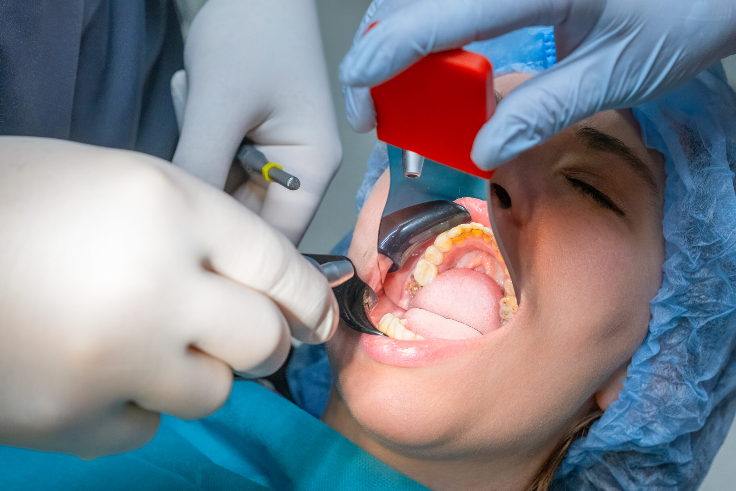 Featured image for “Why February Is the Best Time to Check Your Gum Health”
