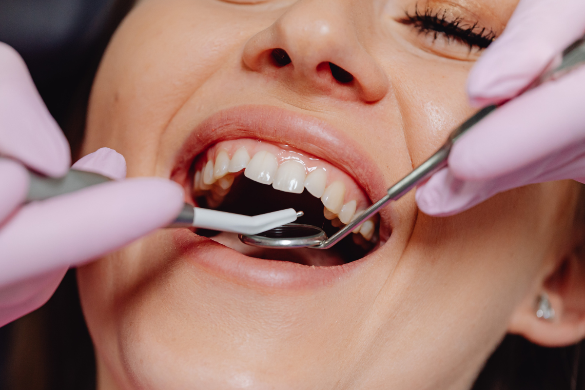Featured image for “Gum Grafting: Understanding How to Protect and Restore Your Gums”