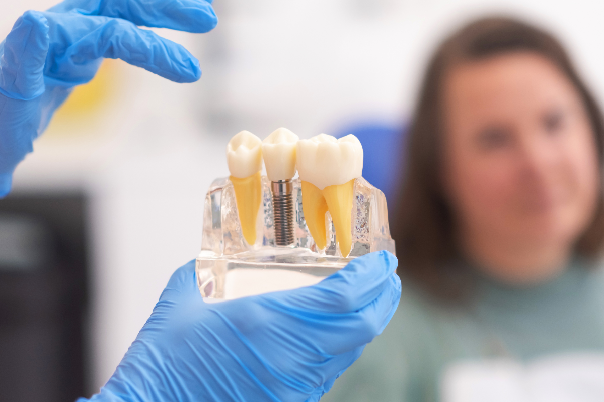 Featured image for “Dental Implants: A Reliable Way to Restore Your Smile and Confidence”