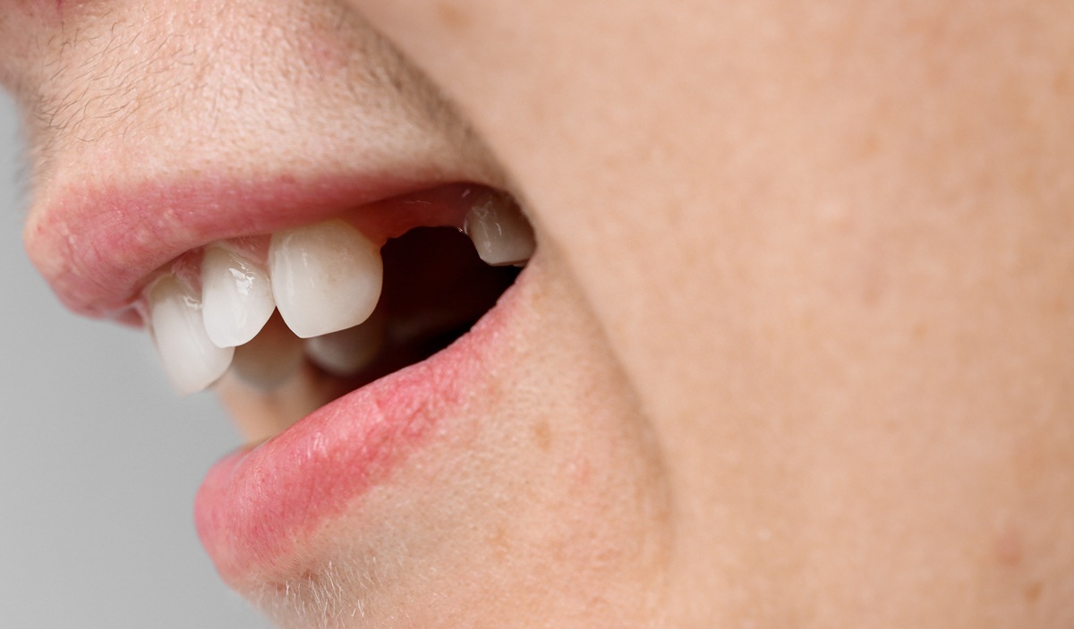 Featured image for “Can One Missing Tooth Cause Other Dental Problems?”