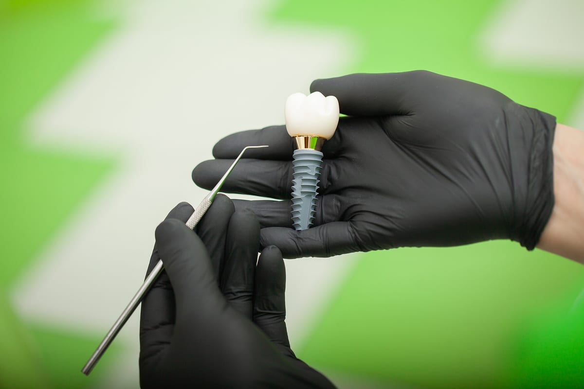 Featured image for “Is Your Mouth Ready for Dental Implants? Here’s What Really Matters”